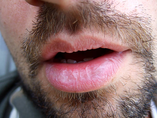 Profilo di Ermenegildo